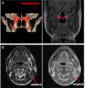 9B4AFC429DCC4F3D24D3F37AC5C_5A9983AE_6057