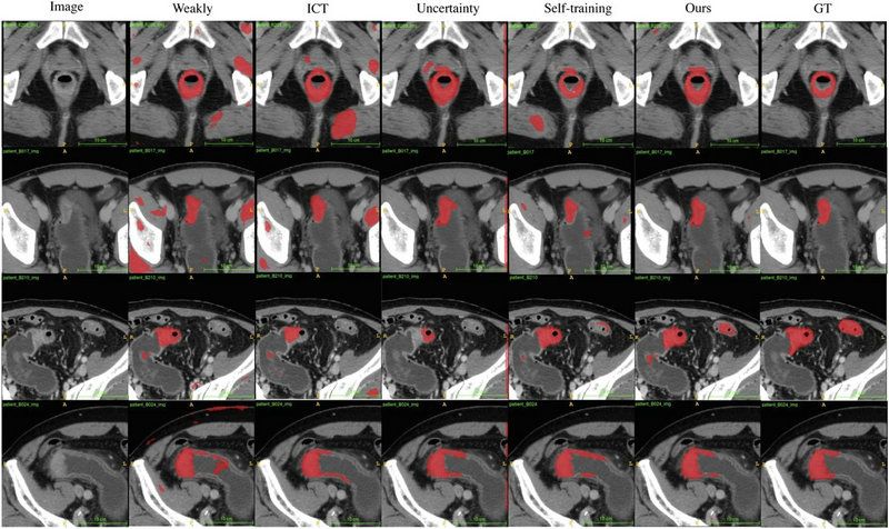 4D7938CC0CF6CA71D3DD7054B75_304418E4_1898E