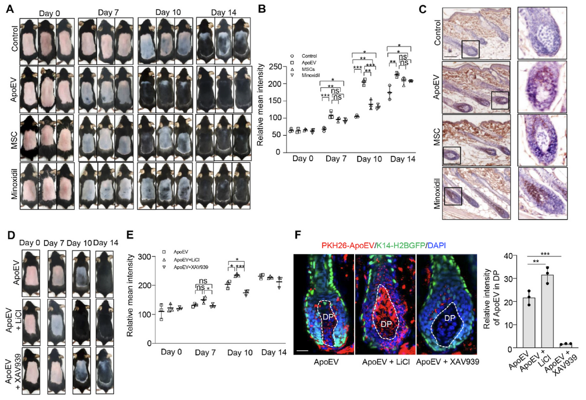 EDD6943F8C241EA1BA516F112F7_B2D5DC1A_152177