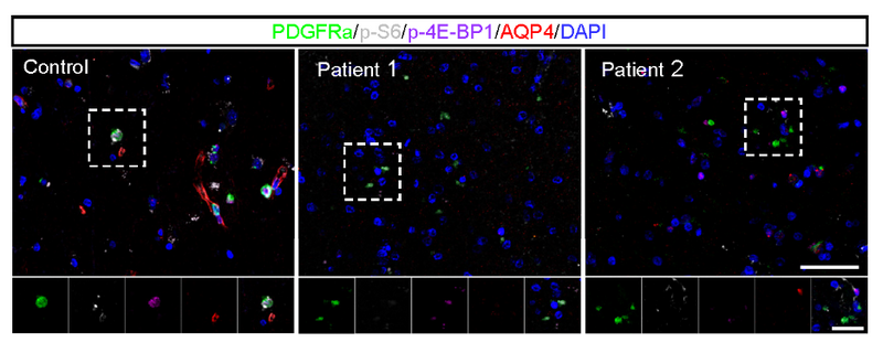 607BDB1EAEBEEEF7C6A2FB53940_AA6D1B37_33634