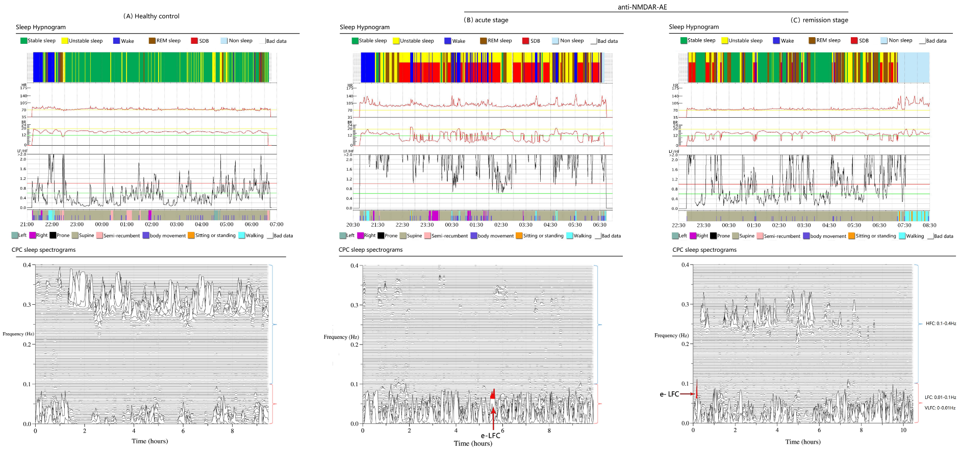 C39898F55A95C77B8320FCBD7EE_2744A7F2_D8E21